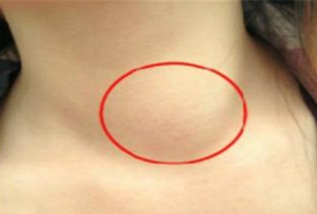 7 bệnh dễ chuyển thành ung thư nhất - 3 7 bệnh dễ chuyển thành ung thư nhất - 3