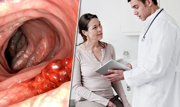 Đột phá trong điều trị ung thư ruột - 1