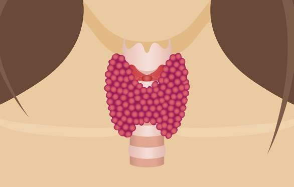 4 dấu hiệu ung thư tuyến giáp cần để ý - 2