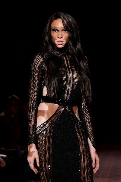 Người mẫu bạch biến đắt show tại tuần lễ thời trang - 4
Winnie Harlow theo đuổi đam mê làm người mẫu từ năm 2013 và dù mắc chứng bạch biến nhưng cô không vì thế mà từ bỏ ước mơ