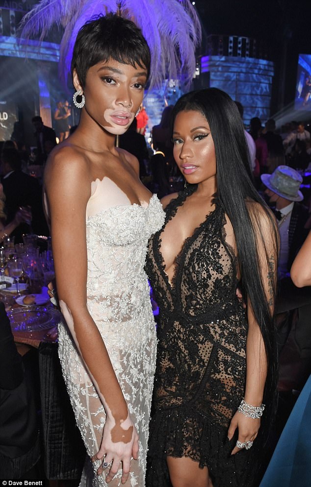 "Chân dài" bạch biến tự tin diện váy xuyên thấu - 6
Winnie Harlow ngồi chung bàn tiệc với Nicki Minaj
