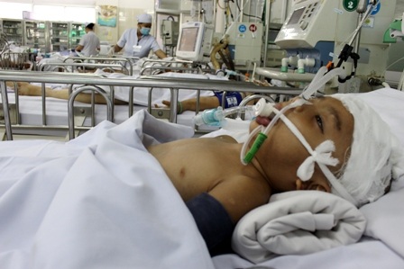 Hơn 10 ngày sau tai nạn, bệnh nhi vẫn hôn mê sâu