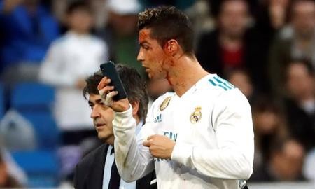 C.Ronaldo đã bị thương trong trận gặp Deportivo