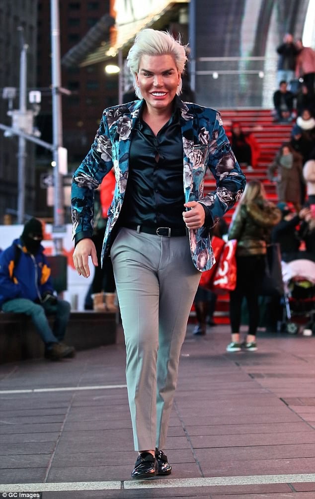 "Búp bê Ken" vui vẻ gặp fans trên phố - 5
Rodrigo Alves cắt bỏ 4 xương sườn để vóc dáng đẹp và chuẩn hơn, anh hồi phục khá nhanh sau ca dau kéo