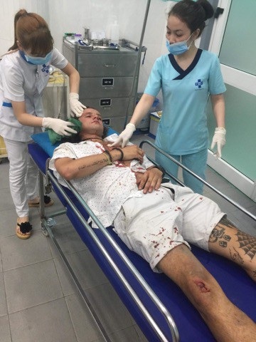 Điều tra vụ du khách người Úc bị nhóm xe ôm Hội An đánh nhập viện - 1 Anh Margan bị đánh với nhiều vết thương trên người