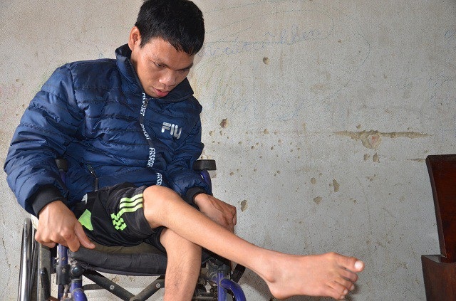 Khốn đốn gia cảnh mẹ tâm thần, con bại liệt - 4 Khốn đốn gia cảnh mẹ tâm thần, con bại liệt - 4