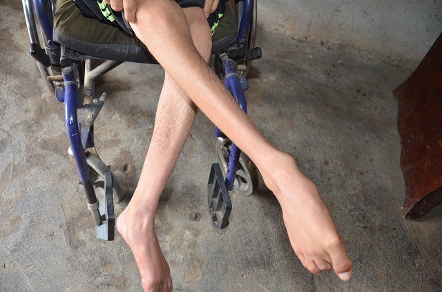 Khốn đốn gia cảnh mẹ tâm thần, con bại liệt - 5 Khốn đốn gia cảnh mẹ tâm thần, con bại liệt - 5