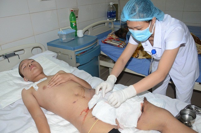 Gặp nạn trên đường đi học, tính mạng cậu bé 15 tuổi nguy kịch - 6 Các y bác sĩ tại viện đang nỗ lực cứu chữa cho Hiếu