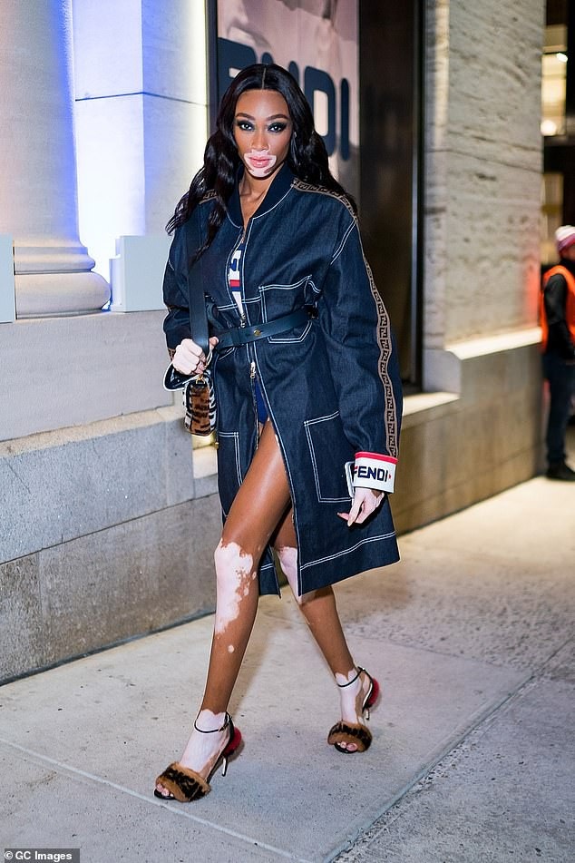 Winnie Harlow ăn vận quá gợi cảm - 2
Siêu mẫu da màu cuốn hút mọi ánh nhìn với trang phục hàng hiệu gợi cảm