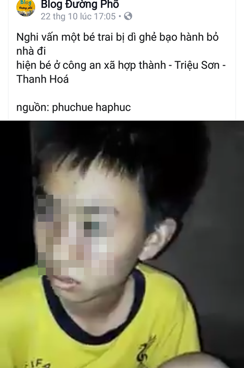 Bé trai bị bố đánh thâm tím, bỏ nhà đi lang thang - Ảnh 1. Bé trai bị bố đánh thâm tím, bỏ nhà đi lang thang - Ảnh 1.