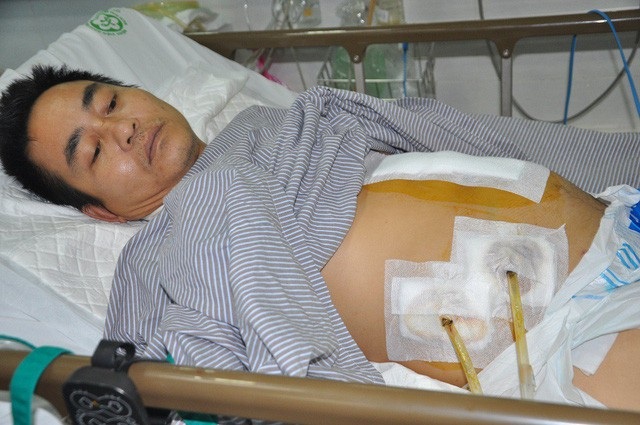 Bị viêm tụy cấp dẫn đến suy đa tạng khiến anh Trường phải điều trị ở khoa Hồi sức tích cực của bệnh viện Bạch Mai.