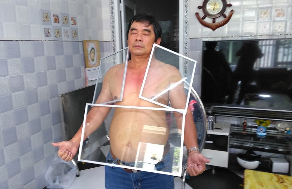 Kỳ lạ người đàn ông có khả năng hút dính kim loại và đá - Ảnh 2. Kỳ lạ người đàn ông có khả năng hút dính kim loại và đá - Ảnh 2.