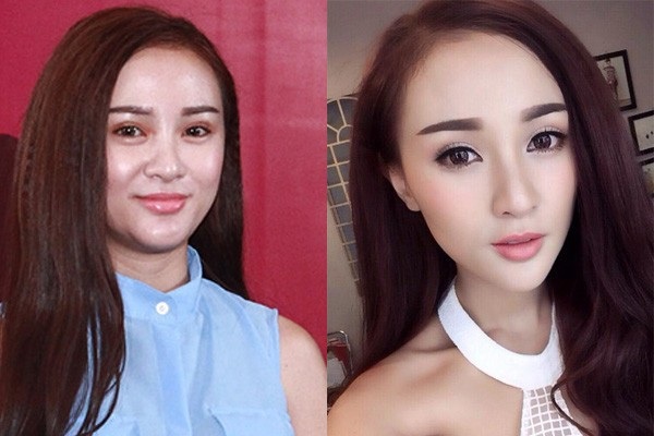 Hot girl Kelly Nguyễn (tên thật là Nguyễn Thụy Tú Anh) cũng là một trong những người đẹp từng gặp “hạn” vì dao kéo.