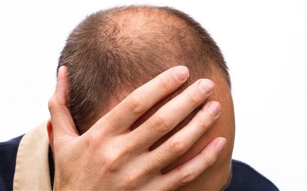 Mướn/Mua Dụng Cụ Hoá Trang ĐẦU TRỌC - Bald Cap Da Trọc Đầu Giá Tốt Nhất Tại  LucTieuMi.com