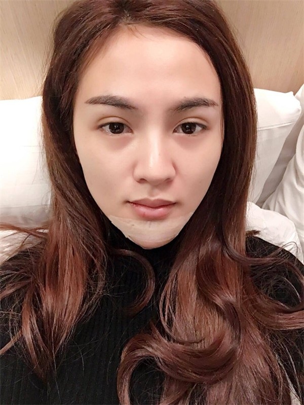 Sau 5 lần phẫu thuật thẩm mỹ, Kelly dần lấy lại tự tin với chiếc cằm V-line hợp mốt. Ngay sau đó, cô lại tiếp tục vướng tin đồn “tân trang” vòng 1. Mọi chuyện chưa dừng lại khi chỉ một thời gian ngắn sau, hot girl sinh năm 1990 quyết định sang Hàn Quốc để sửa cằm lần thứ 6, Kelly tiết lộ chi phí cô bỏ ra cho cuộc phẫu thuật này lên tới 200 triệu đồng.