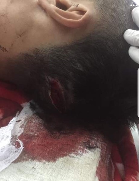 Camera ghi lại cảnh côn đồ mang dao phóng lợn vào tận nhà dân truy sát dã man - Ảnh 3.