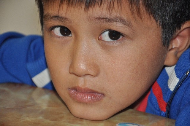 Hơn 132 triệu đồng đến với cậu bé Việt Anh bị ung thư hạch - 1 Việt Anh bị ung thư hạch nên phải theo điều trị hóa chất.