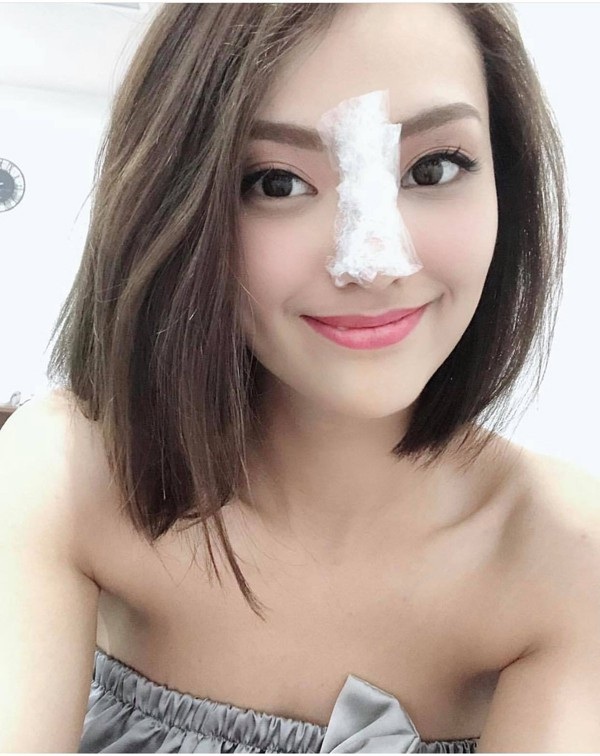 Hồng Quế công khai chuyện làm mũi, cho rằng “mũi gồ vất vả tình duyên” - 7 Hồng Quế công khai chuyện làm mũi, cho rằng “mũi gồ vất vả tình duyên” - 7