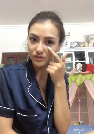 Hồng Quế công khai chuyện làm mũi, cho rằng “mũi gồ vất vả tình duyên” - 6 “Đau lúc tiêm tê như chết đi sống lại sau đó thì không đau, chịu được. Quế làm đúng 10 phút và mới làm xong thì mũi vẫn bị đỏ và tím hai bên nhưng vài hôm nữa hết sưng thì sẽ đẹp hơn nữa”, Hồng Quế chia sẻ. Người đẹp cũng tâm sự chiếc mũi sẽ đẹp trong khoảng 5-8 năm chứ không được vĩnh viễn. Cô dự định sẽ làm thêm cho hết nhăn ở mắt và quầng thâm.