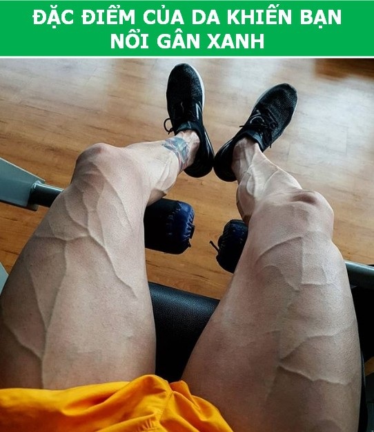 Tại sao cơ thể của bạn lại “nổi gân xanh” trong khi người khác lại không? - 1 Tại sao cơ thể của bạn lại “nổi gân xanh” trong khi người khác lại không? - 1