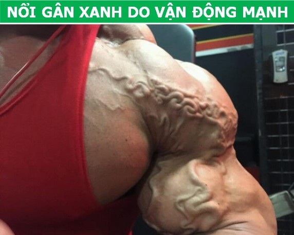 Tại sao cơ thể của bạn lại “nổi gân xanh” trong khi người khác lại không? - 2 Tại sao cơ thể của bạn lại “nổi gân xanh” trong khi người khác lại không? - 2