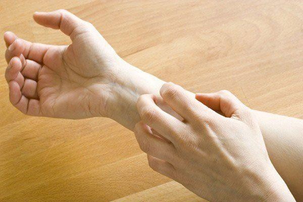 Bệnh vảy nến và những biến chứng nguy hiểm khôn lường - 3 Vảy nến có thể gây ngứa ngáy