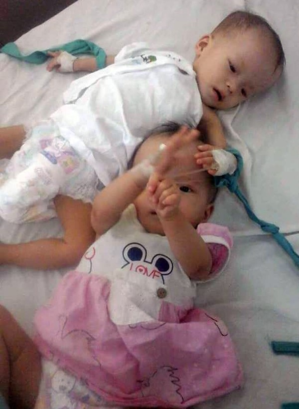 Xót xa vợ chồng trẻ sinh đôi hai bé gái thì "một bé mất, một bé nguy kịch" - 1 Hai bé Bảo Lâm (áo hồng), Bảo Loan ốm yếu, được bố mẹ cho nhập viện.