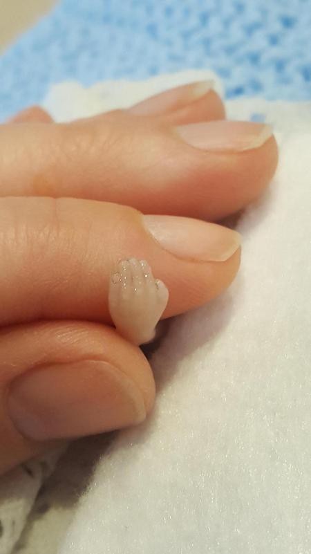Quá tiếc thương, cha mẹ cất con sinh non 14 tuần tuổi trong tủ lạnh - 2 Bàn tay của bé còn không to bằng một đốt ngón tay của mẹ
