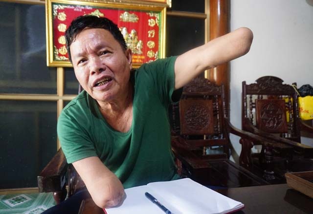 Người thương binh tự làm mọi việc từ đôi tay không còn bàn tay - 1 Cựu lính pháo binh Nguyễn Văn Linh và đôi bàn tay cụt đến khuỷu