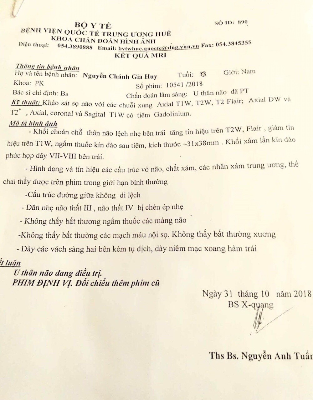Sự sống mong manh của bé 8 tuổi mắc bệnh u não - Ảnh 3. Sự sống mong manh của bé 8 tuổi mắc bệnh u não - Ảnh 3.