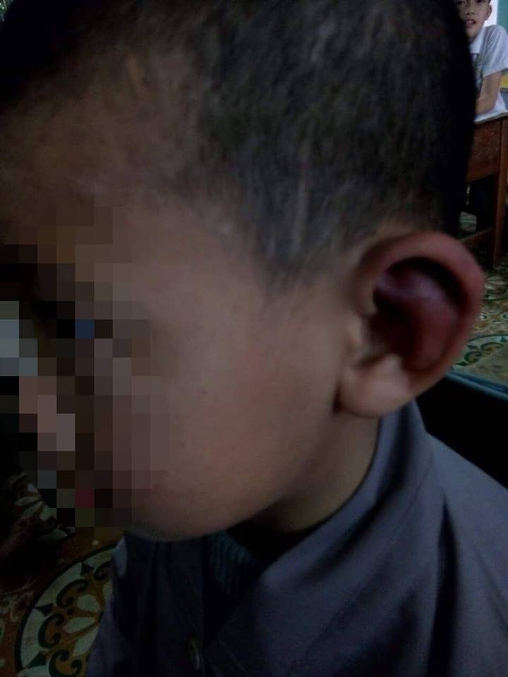 Cháu bé mồ côi không dám kể chuyện bị sư thầy bạo hành vì sợ bị... đánh chết! - Ảnh 3. Cháu bé mồ côi không dám kể chuyện bị sư thầy bạo hành vì sợ bị... đánh chết! - Ảnh 3.