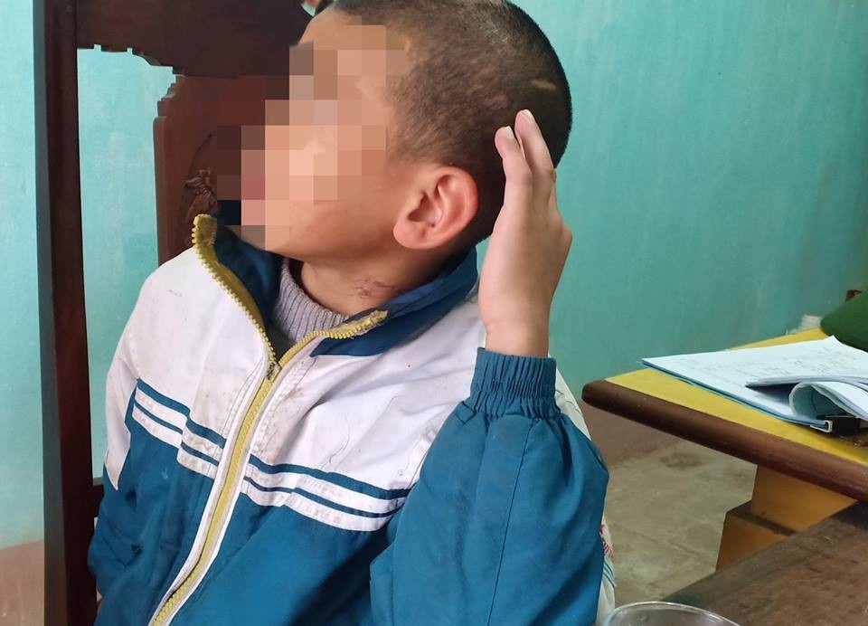 Cháu bé mồ côi không dám kể chuyện bị sư thầy bạo hành vì sợ bị... đánh chết! - Ảnh 4. Cháu bé mồ côi không dám kể chuyện bị sư thầy bạo hành vì sợ bị... đánh chết! - Ảnh 4.