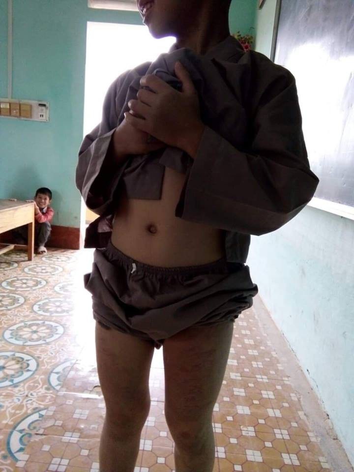 Cháu bé mồ côi không dám kể chuyện bị sư thầy bạo hành vì sợ bị... đánh chết! - Ảnh 2. Cháu bé mồ côi không dám kể chuyện bị sư thầy bạo hành vì sợ bị... đánh chết! - Ảnh 2.