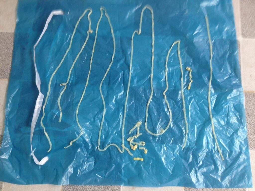 Cảnh báo bệnh lợn gạo lây sang người qua ăn uống - Ảnh 1. Cảnh báo bệnh lợn gạo lây sang người qua ăn uống - Ảnh 1.