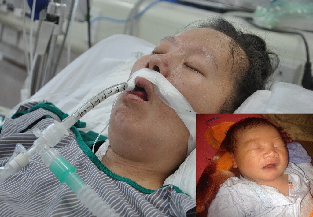 Sinh con được 2 tháng, người mẹ trẻ dân tộc Mông rơi vào tình cảnh nguy kịch - Ảnh 5. Sinh con được 2 tháng, người mẹ trẻ dân tộc Mông rơi vào tình cảnh nguy kịch - Ảnh 5.