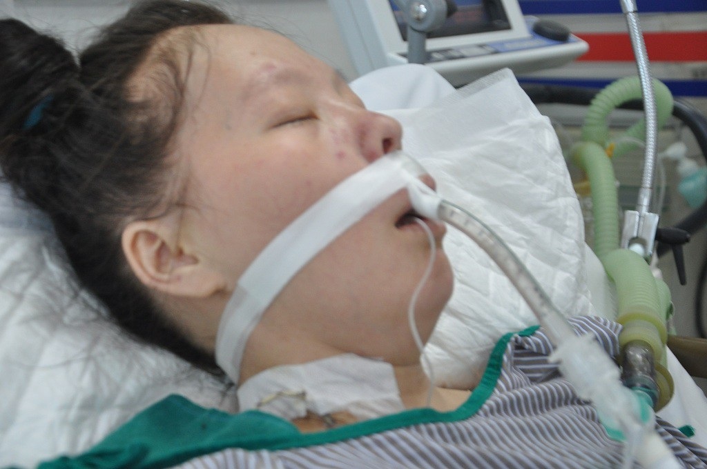 Sinh con được 2 tháng, người mẹ trẻ dân tộc Mông rơi vào tình cảnh nguy kịch - Ảnh 2. Sinh con được 2 tháng, người mẹ trẻ dân tộc Mông rơi vào tình cảnh nguy kịch - Ảnh 2.