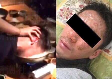 Nhật Bản: Ông chủ nhúng mặt nhân viên vào nồi lẩu để mua vui - 1 “Trò đùa” quái ác này khiến nhiều người kinh hãi