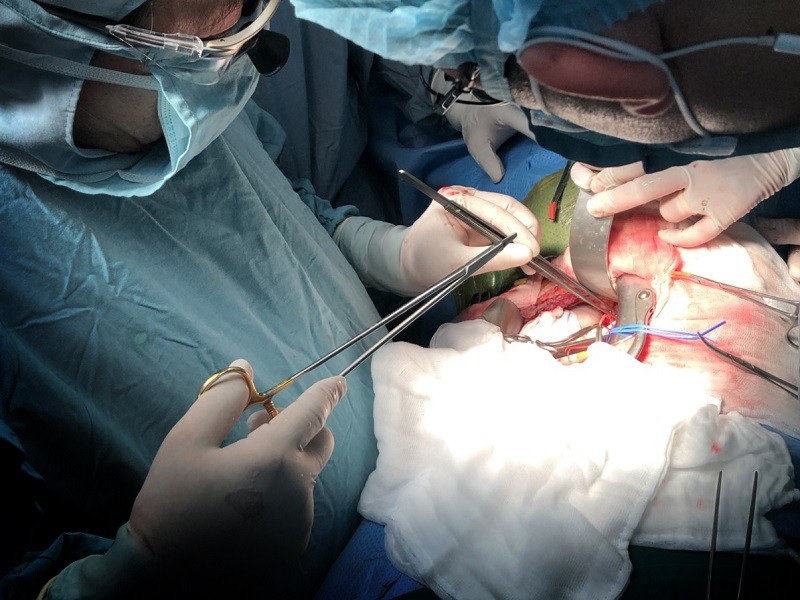 Lần đầu tiên ghép thận trên bệnh nhi từ người cho chết não - Ảnh 1. Lần đầu tiên ghép thận trên bệnh nhi từ người cho chết não - Ảnh 1.