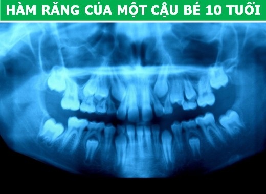 Cơ thể con người cực lạ qua các công nghệ chụp, quét y học hiện đại - Ảnh 2. Cơ thể con người cực lạ qua các công nghệ chụp, quét y học hiện đại - Ảnh 2.