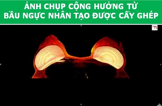 Cơ thể con người cực lạ qua các công nghệ chụp, quét y học hiện đại - Ảnh 3. Cơ thể con người cực lạ qua các công nghệ chụp, quét y học hiện đại - Ảnh 3.