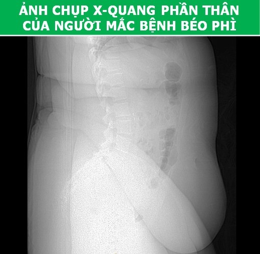 Cơ thể con người cực lạ qua các công nghệ chụp, quét y học hiện đại - Ảnh 5. Cơ thể con người cực lạ qua các công nghệ chụp, quét y học hiện đại - Ảnh 5.