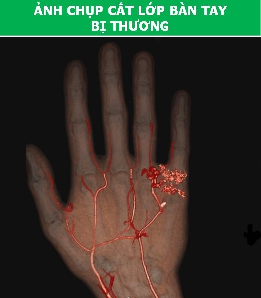 Cơ thể con người cực lạ qua các công nghệ chụp, quét y học hiện đại - Ảnh 7. Cơ thể con người cực lạ qua các công nghệ chụp, quét y học hiện đại - Ảnh 7.