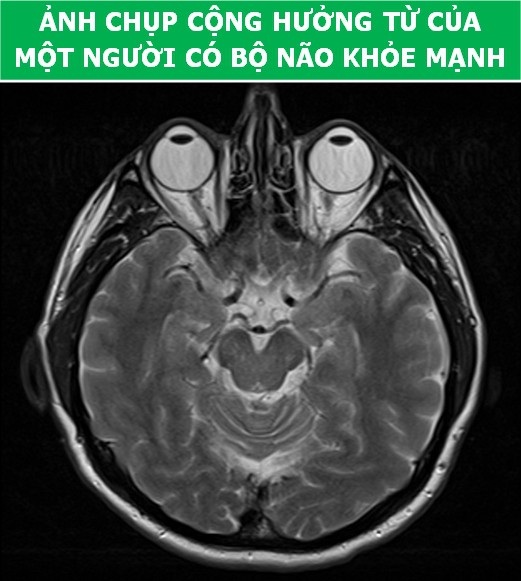 Cơ thể con người cực lạ qua các công nghệ chụp, quét y học hiện đại - Ảnh 9. Cơ thể con người cực lạ qua các công nghệ chụp, quét y học hiện đại - Ảnh 9.