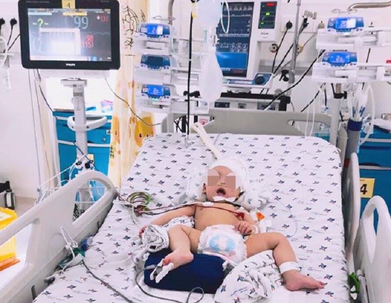 Bé 8 tháng tuổi đột ngột co giật vì xuất huyết não cấp không rõ nguyên nhân - Ảnh 1. Bé 8 tháng tuổi đột ngột co giật vì xuất huyết não cấp không rõ nguyên nhân - Ảnh 1.