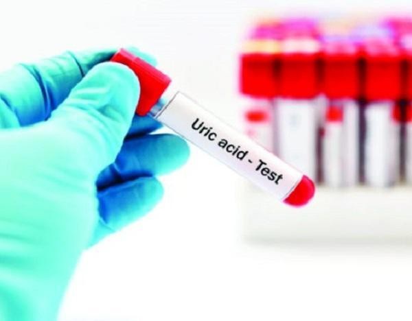 5 cách tự nhiên giúp giảm axit uric, ngăn ngừa bệnh gút tại nhà - Ảnh 1.