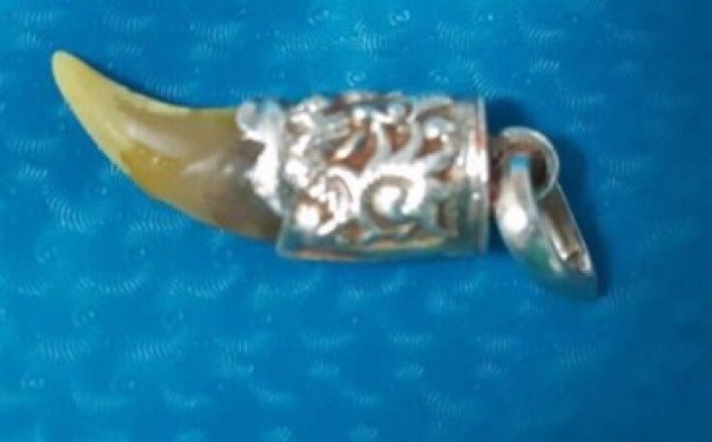Lấy thành công nanh hổ trong tá tràng bé 23 tháng tuổi - 1 Chiếc nanh hổ trong bụng cháu bé 23 tháng tuổi.