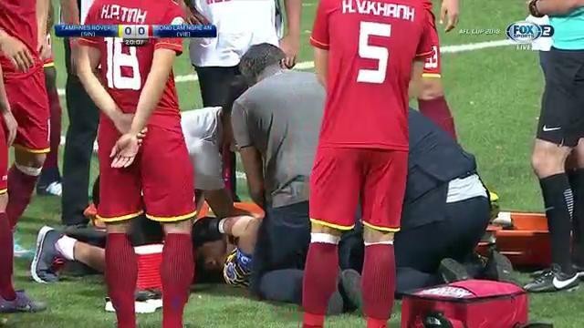 Nguyên Mạnh gãy tay kinh hoàng, SL Nghệ An có 3 điểm đầu tay ở AFC Cup - 2
Thủ môn Nguyên Mạnh bị gãy tay đầy đáng tiếc
