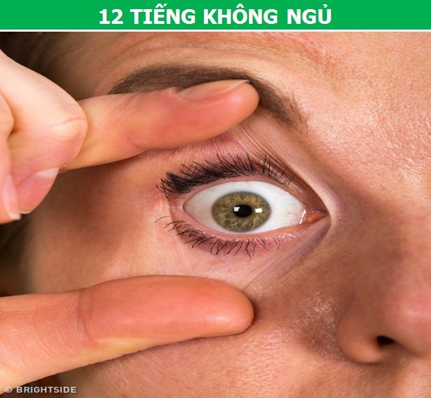 Cái chết sẽ đến với chúng ta như thế nào nếu “thức trắng” nhiều ngày liền? - 2 Cái chết sẽ đến với chúng ta như thế nào nếu “thức trắng” nhiều ngày liền? - 2