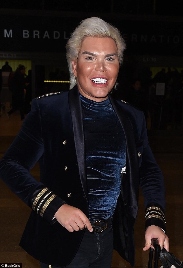 
Rodrigo Alves cũng đang có ý định gây quỹ ủng hộ những người nghèo muốn phẫu thuật thẩm mỹ mà không đủ điều kiện
