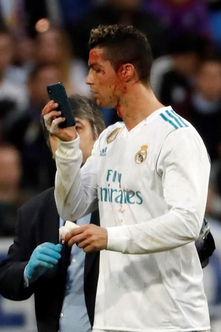 Bước sang tuổi 33, C.Ronaldo có cả ngàn lí do để yêu ghét đong đầy - 14 Màu mè là vậy nhưng ai lại nỡ hờn trách C.Ronaldo khi mà anh chàng bị thương trên sân, máu chảy be bét vẫn cố dùng điện thoại để soi ngắm nhan sắc. Điệu đà, đỏm dáng nhưng vẫn rất mực máu lửa, đó mới là CR7 được người người yêu mến.